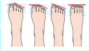 vorm van voeten